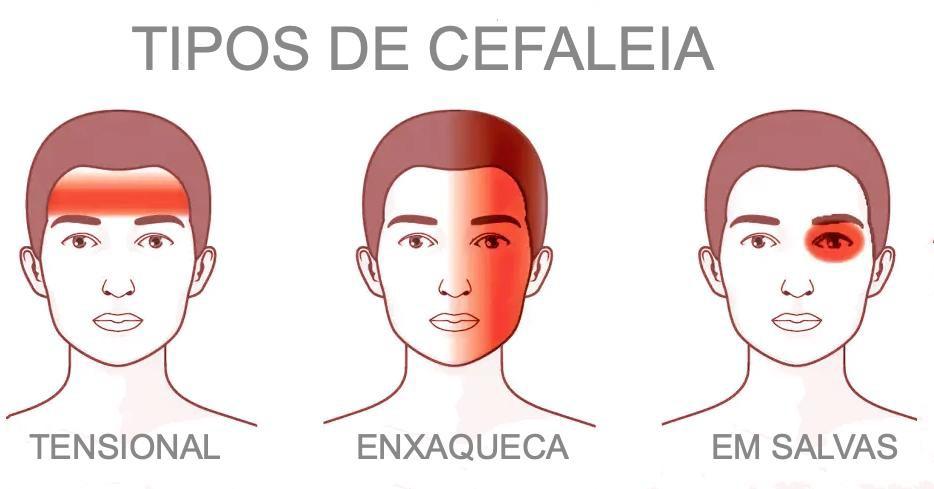 Dor de cabeça 